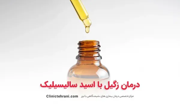  قیمت اسید سالیسیلیک برای زگیل تناسلی/قطره زگیل