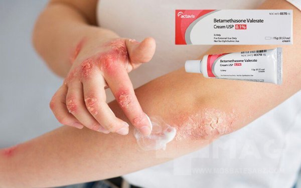  پماد بتامتازون برای چه کاریه+پماد بتامتازون برای واژن