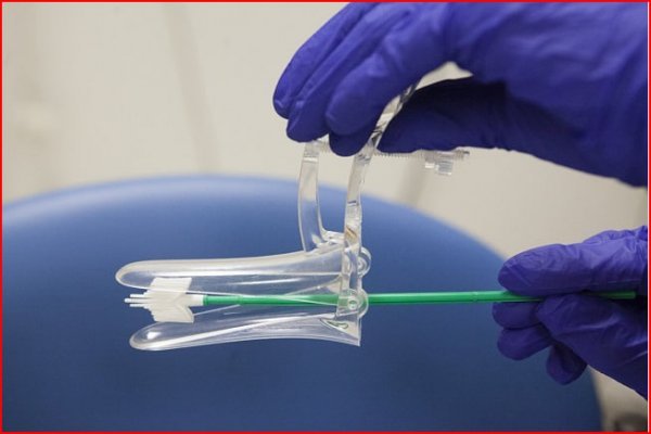 فیلم و عکس تست پاپ اسمیر