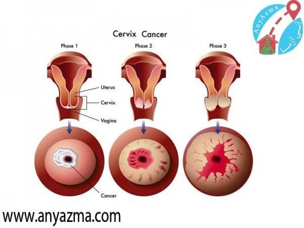  فیلم و عکس تست پاپ اسمیر