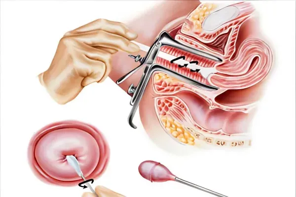  فیلم و عکس تست پاپ اسمیر