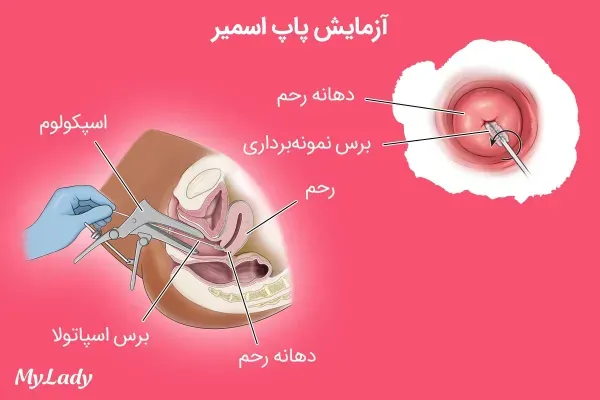  سکس رابطه جنسی بعد از تست پاپ اسمیر