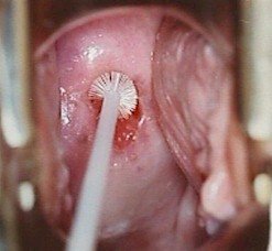  بعد از پاپ اسمیر چه کنیم؟