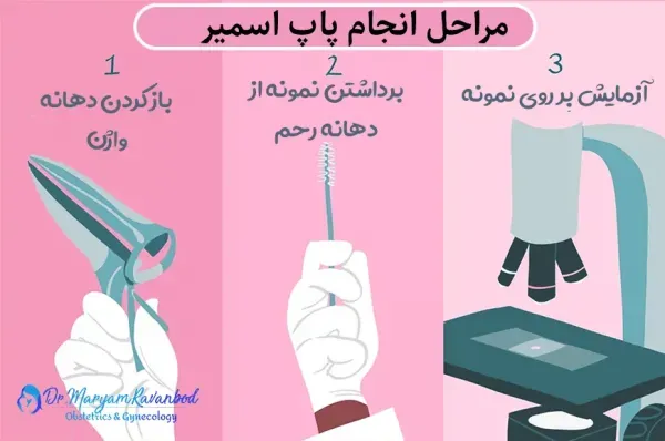  بعد از پاپ اسمیر چه کنیم؟