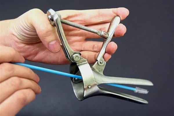  ترشحات قهوه ای بعد از پاپ اسمیر