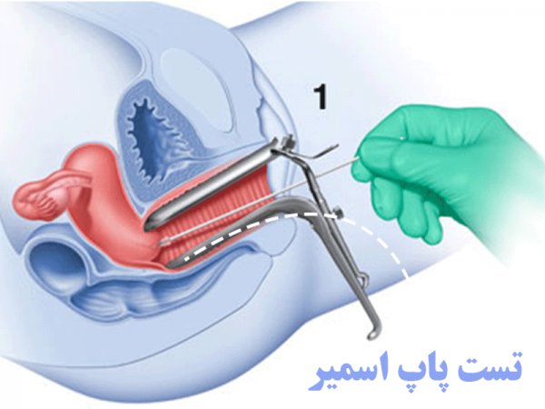  قیمت آزمایش / تست پاپ اسمیر چقدر است/سال 1404