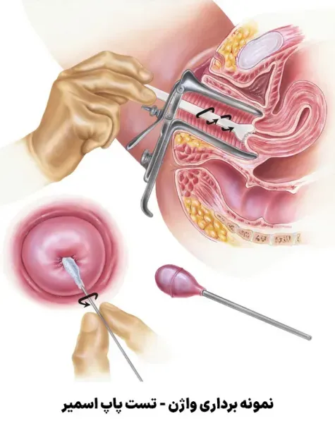  قیمت آزمایش / تست پاپ اسمیر چقدر است/سال 1404