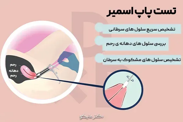  قیمت آزمایش / تست پاپ اسمیر چقدر است/سال 1404