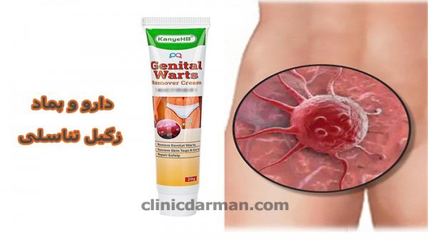  درمان زگیل تناسلی در زنان چقدر طول میکشد؟