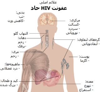  پرسش و پاسخ در مورد بیماری ایدز اچ ای وی HIV