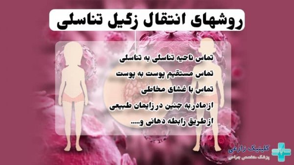  آیا اچ پی وی HPV از طریق بوسه منتقل می شود؟
