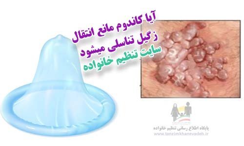  آیا اچ پی وی HPV از طریق بوسه منتقل می شود؟