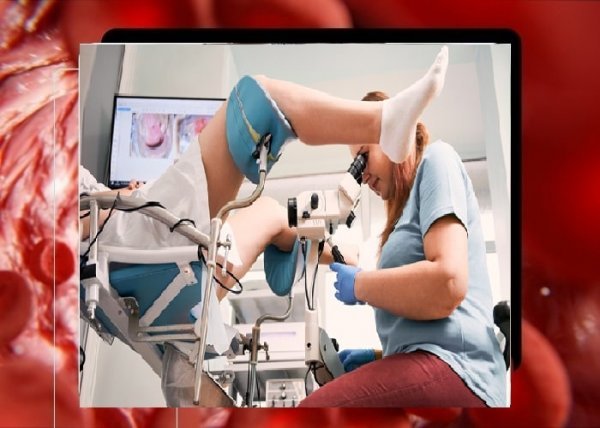  از چه سنی باید تست پاپ اسمیر انجام داد؟