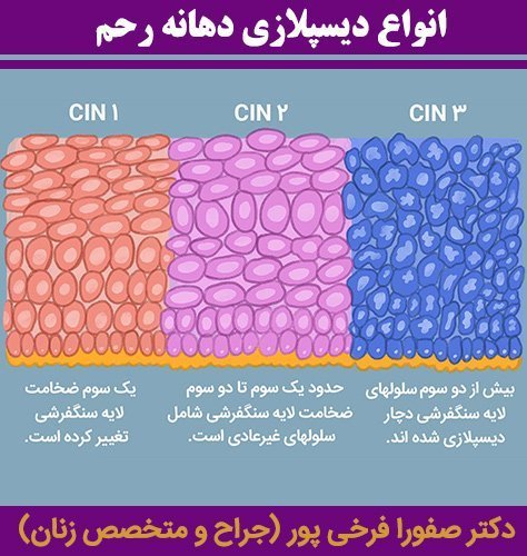  اگر نتیجه / جواب کولپوسکوپی مثبت باشد چه میشود؟