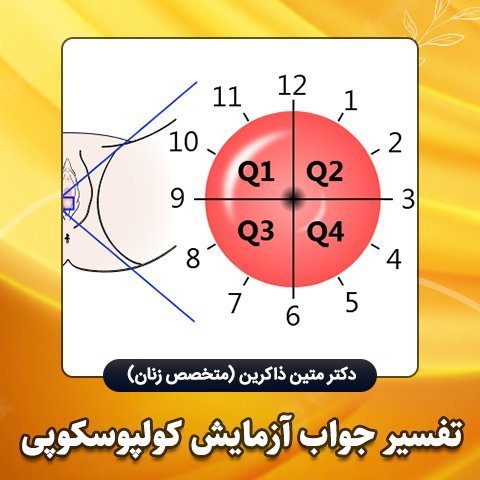  اگر نتیجه / جواب کولپوسکوپی مثبت باشد چه میشود؟