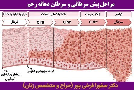  اگر نتیجه / جواب کولپوسکوپی مثبت باشد چه میشود؟
