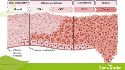  اگر نتیجه / جواب کولپوسکوپی مثبت باشد چه میشود؟