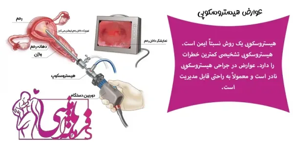  هیستروسکوپی برای چی انجام میشه؟