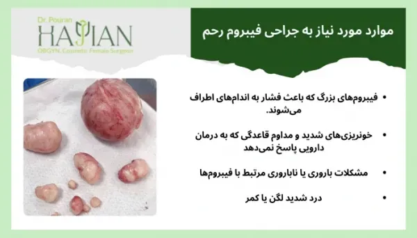  هیستروسکوپی برای چی انجام میشه؟