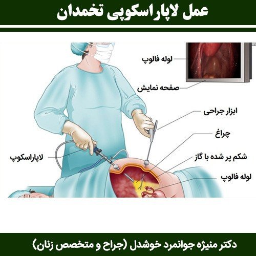  آیا بعد از برداشتن رحم واژن گشاد میشود؟