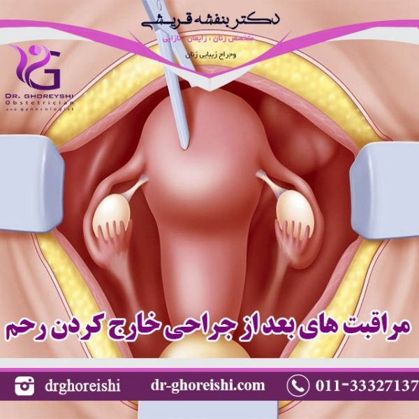  آیا بعد از برداشتن رحم واژن گشاد میشود؟