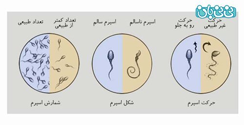  عکس جواب آزمایش اسپرم نرمال/اسپرم قوی/اسپرم ضعیف