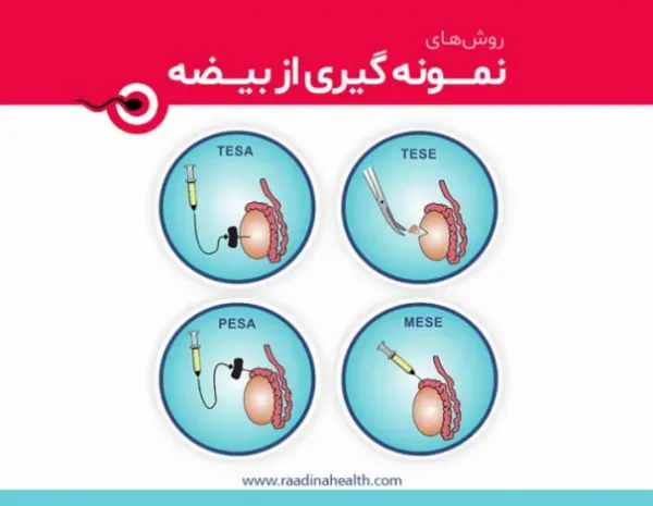  از کجا بفهمیم اسپرم سالمی داریم؟