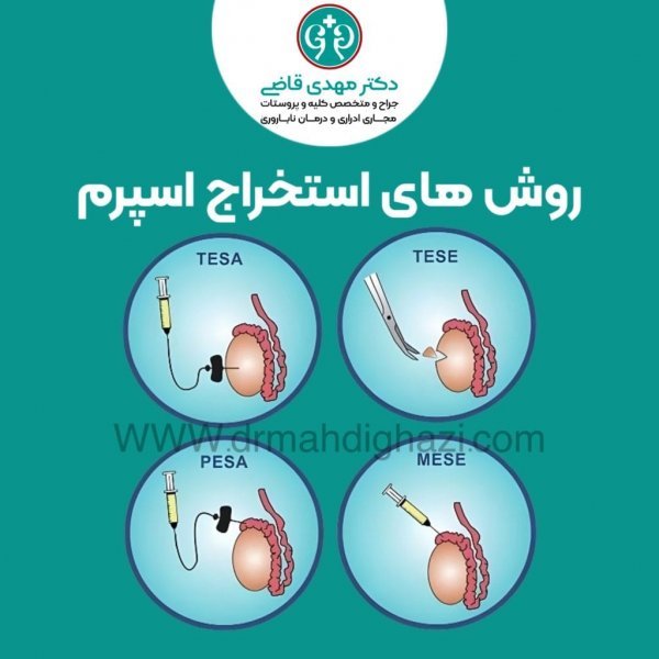  از کجا بفهمیم اسپرم سالمی داریم؟