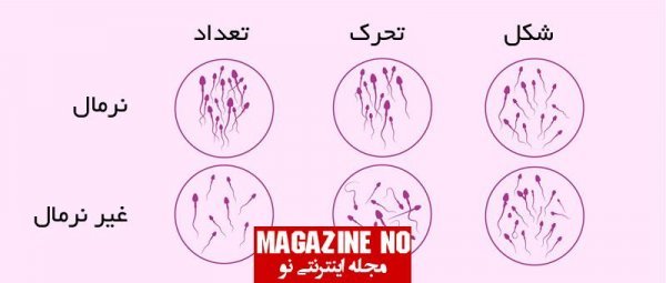  دلیل بی رنگ بودن اسپرم / رنگ اسپرم سالم