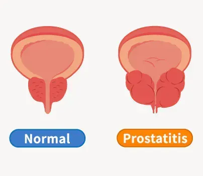  دلیل بی رنگ بودن اسپرم / رنگ اسپرم سالم