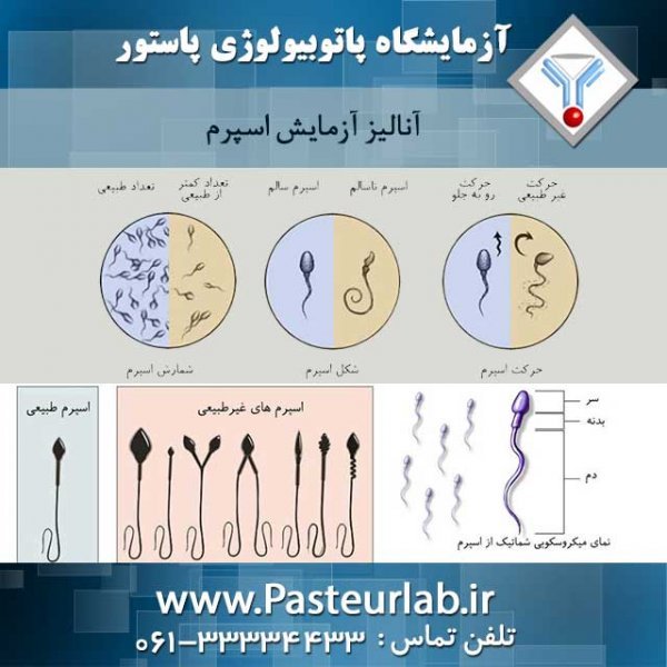  دلیل بی رنگ بودن اسپرم / رنگ اسپرم سالم