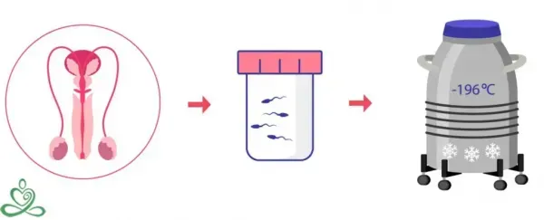  شرایط فریز اسپرم / روش فریز اسپرم / نحوه فریز اسپرم