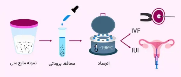  اسپرم فریز شده یعنی چی / هزینه فریز اسپرم 1404