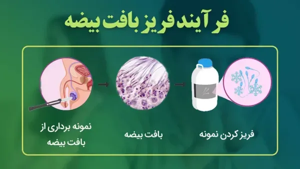  اسپرم فریز شده یعنی چی / هزینه فریز اسپرم 1404