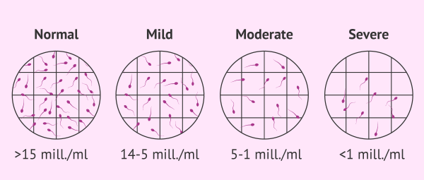  اسپرم فریز شده تا چند سال قابل استفاده است؟