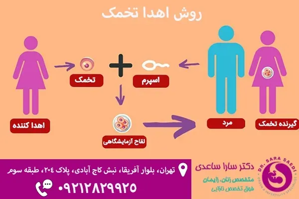  آیا اهدای تخمک باعث نازایی میشود/تجربه زنان پس از اهدای تخمک