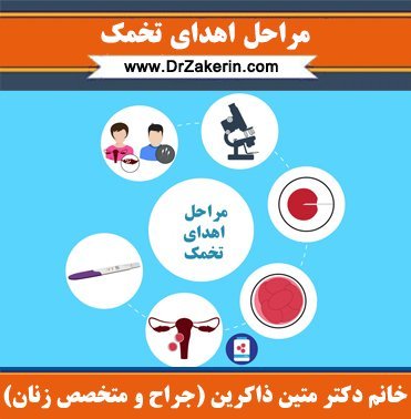  آیا اهدای تخمک باعث نازایی میشود/تجربه زنان پس از اهدای تخمک