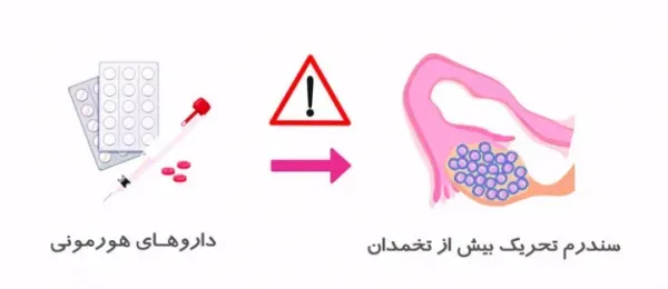  آیا اهدای تخمک باعث نازایی میشود/تجربه زنان پس از اهدای تخمک