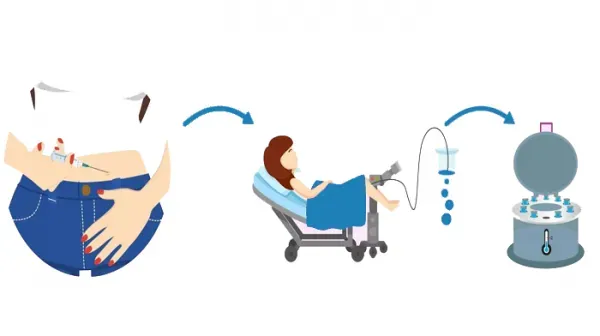  مراکز دولتی فریز تخمک در تهران/دکتر خوب برای فریز تخمک