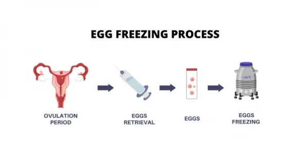  مراکز دولتی فریز تخمک در تهران/دکتر خوب برای فریز تخمک