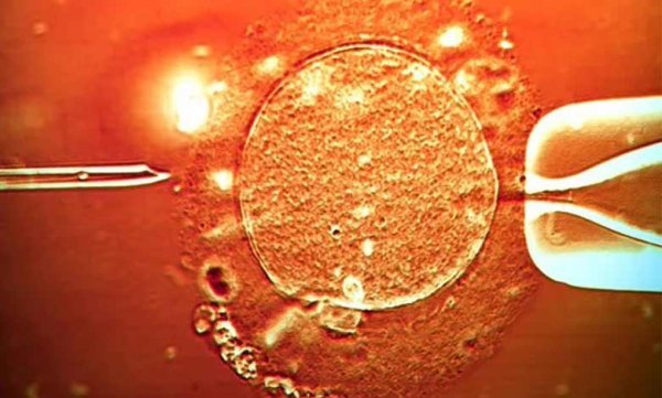  مراکز دولتی فریز تخمک در تهران/دکتر خوب برای فریز تخمک