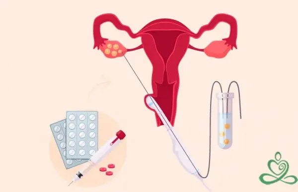  مراکز دولتی فریز تخمک در تهران/دکتر خوب برای فریز تخمک