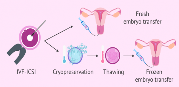  فریز تخمک بهتر است یا فریز جنین/ عکس جنین فریز شده سه روزه