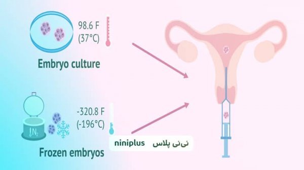  فریز تخمک بهتر است یا فریز جنین/ عکس جنین فریز شده سه روزه