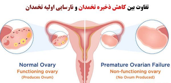  پروسه فریز تخمک چقدر طول میکشد؟