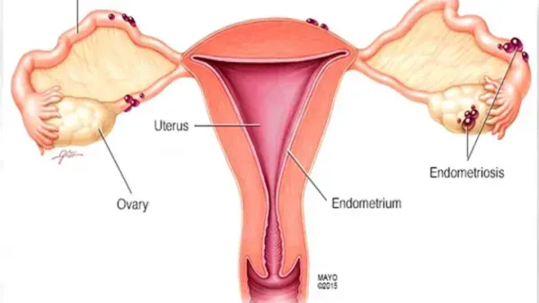  پروسه فریز تخمک چقدر طول میکشد؟