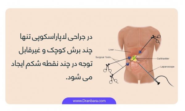  جراحی روده به چه صورت است؟