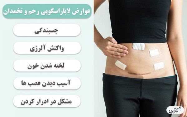  لاپاراسکوپی رحم از واژن