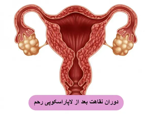  لاپاراسکوپی رحم از واژن
