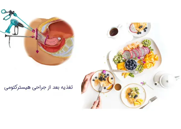  هزینه عمل فیبروم رحم با لیزر